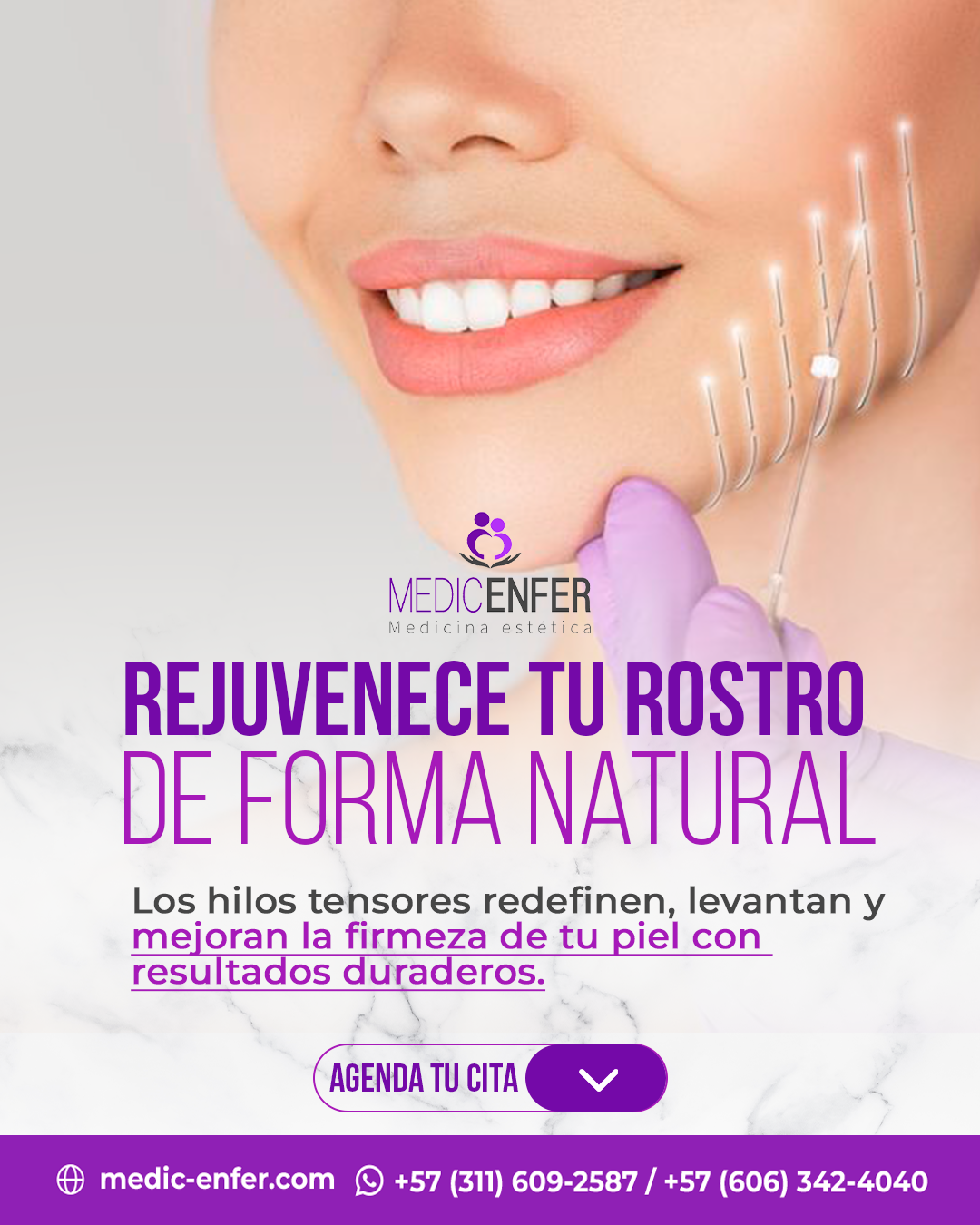 Rejuvenecimiento facial