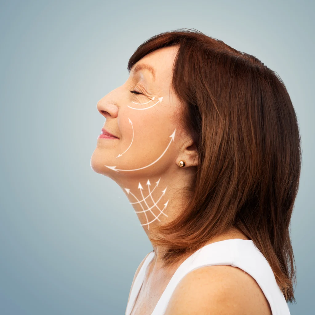 Rejuvenecimiento facial